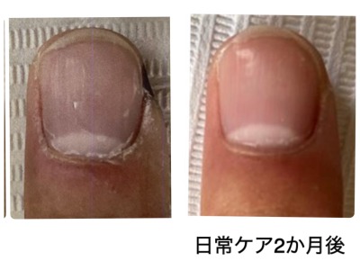 BEFORE AFTER