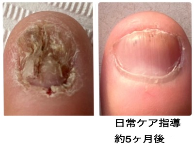 BEFORE AFTER