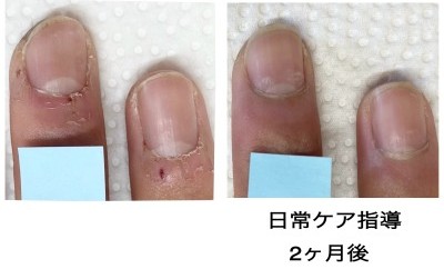 BEFORE AFTER