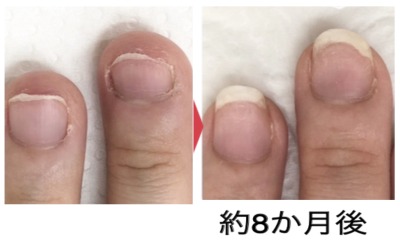 BEFORE AFTER
